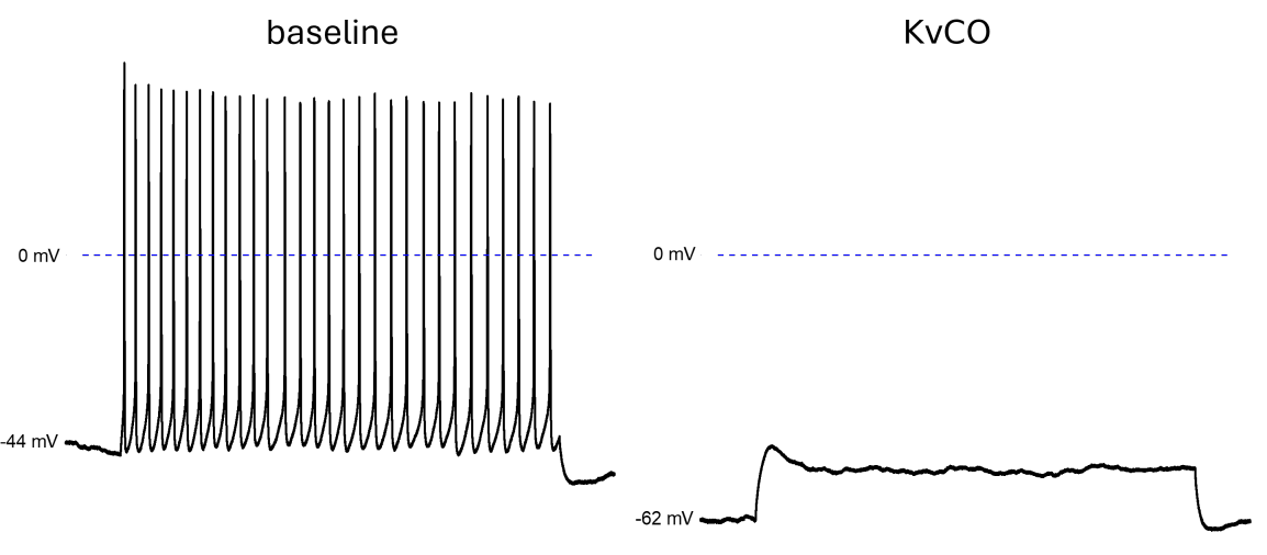 Action Potential Suppression